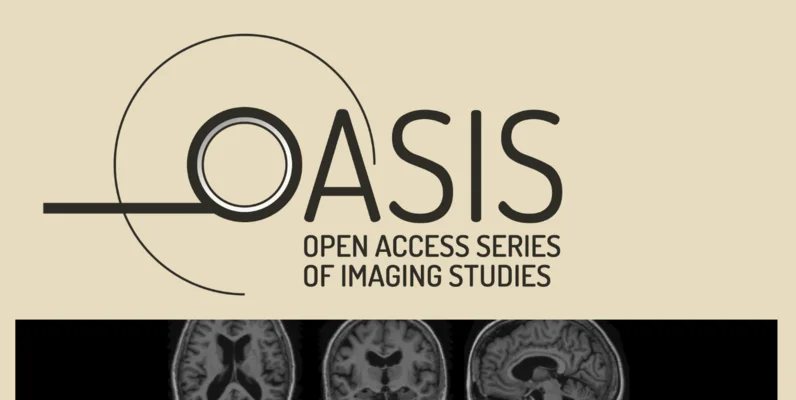 Dementia Classification AI